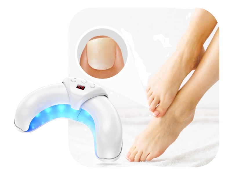 FungaBeam Reviews Advanced At-Home Nail Fungus LLLT Device for Toenail Health